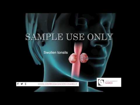 1 Trattamento vertebra cervicale Mal di collo e presse nel cuore