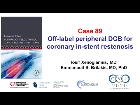 Case 89: PCI Manual - Peripheral DCB for coronary ISR