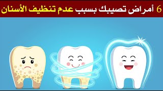 6 أمراض تصيبك بسبب عدم تنظيف الأسنان
