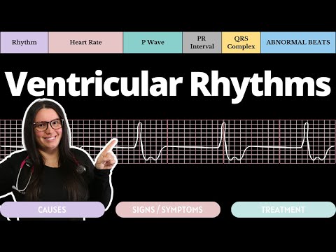 Ventricular Rhythms on an EKG with Qs | Circulatory System and Disease | NCLEX-RN | Nurse Cheung