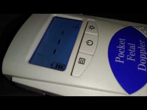 7 WEEKS FETAL DOPPLER BABY'S HEARTBEAT!