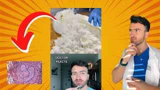What draining an abscess feels like