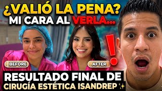 ¿VALIÓ LA PENA? 🏥 Mi opinión antes y mi cara al ver el resultado final ✨