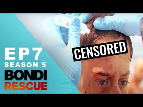 Boy Gets MASSIVE Gash After Falling | Bondi Rescue - Season 5 Episode 7 (OFFICIAL UPLOAD)