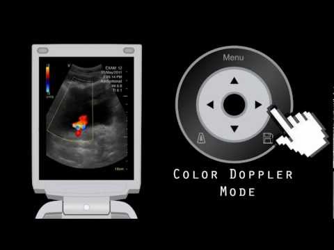 Introduction to GE Vscan Portable Ultrasound Device