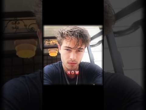 Prime is unmoggable☠️|Chico lachowski #looksmaxxing #model #nowvsthen #prime