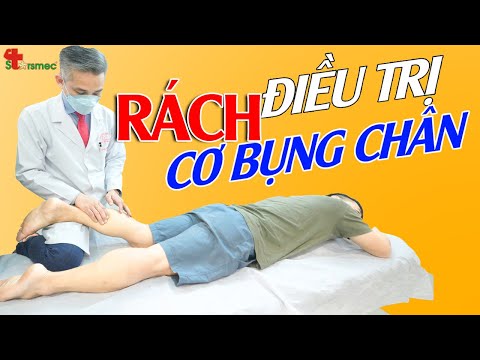 Rách cơ bụng chân - Điều trị thế nào?