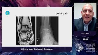 Ankle Symposium