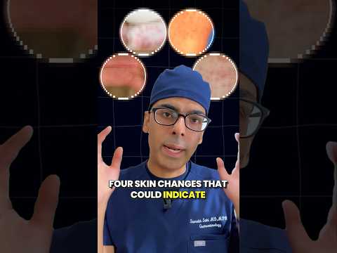 Doctor Sethi : 4 Skin Changes That Could Indicate Liver Disease ❌