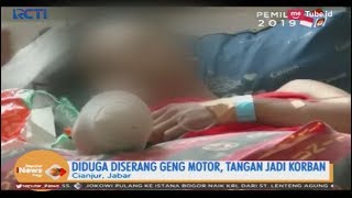 Download lagu Jadi Korban Aksi Brutal Geng Motor, Pria di Cianjur Kehilangan Tangan Kanannya - SIP 07/03 mp3