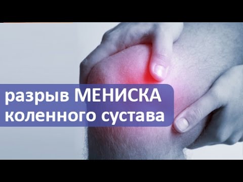 Боль в спине центральная часть Как правильно сделать компресс на локтевой сустав