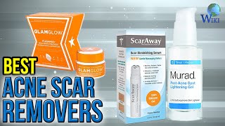 10 Best Acne Scar Removers 2017