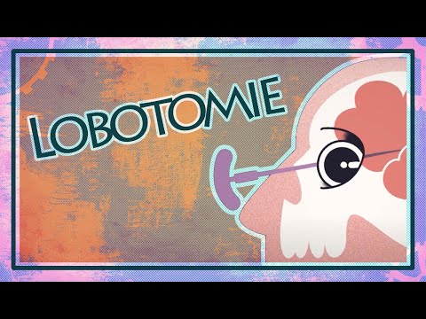 La Lobotomie - PRIX NOBEL OU MUTILATION ?