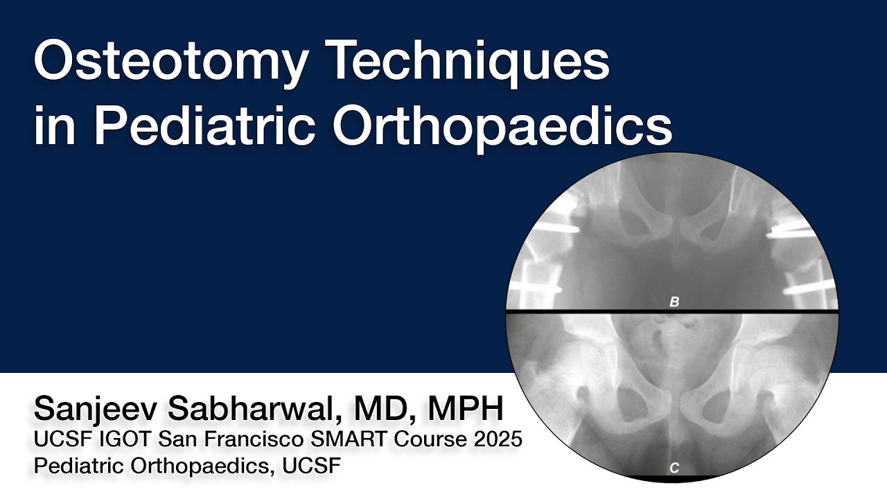 Osteotomy Techniques in Pediatric Orthopaedics | Sanjeev Sabharwal, MD, MPH