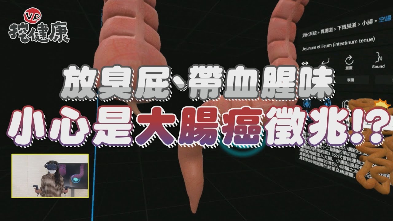 狂放臭屁恐是大腸癌!醫曝3種屁味最危險:快去醫院檢查