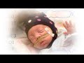 Infant EEG Study In BABA Center