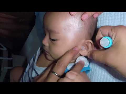 Cute 3 Month Old Baby Boy's Earwax Removal