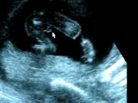 Meet our baby...he's a boy! He's Jett!