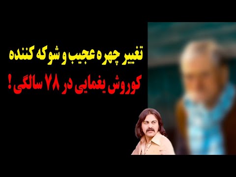 تغییر چهره عجیب و شوکه کننده کوروش یغمایی در ۷۸ سالگی !