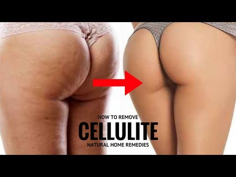 Ang pinakamahusay na paraan upang kumuha alisan ng cellulite review Isang hanay ng mga pagsasanay para sa pagbaba ng timbang mula sa