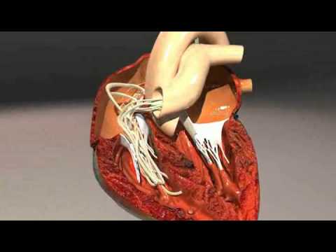 Heartworms a deadly blood parasite