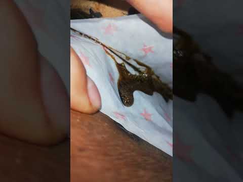rosin hash