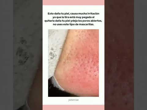 💗🥛°•que no hacer para arruinar tu hermosa piel •°💗🥛 #cuidadosdelapiel  #wonyoungism