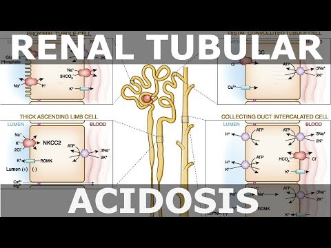 Renale tubuläre Azidose