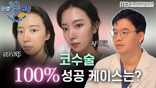 [성형외과 전문의 Q&A] 코수술, 예뻐지는 유형은 따로 있습니다(코성형 자가진단법)
