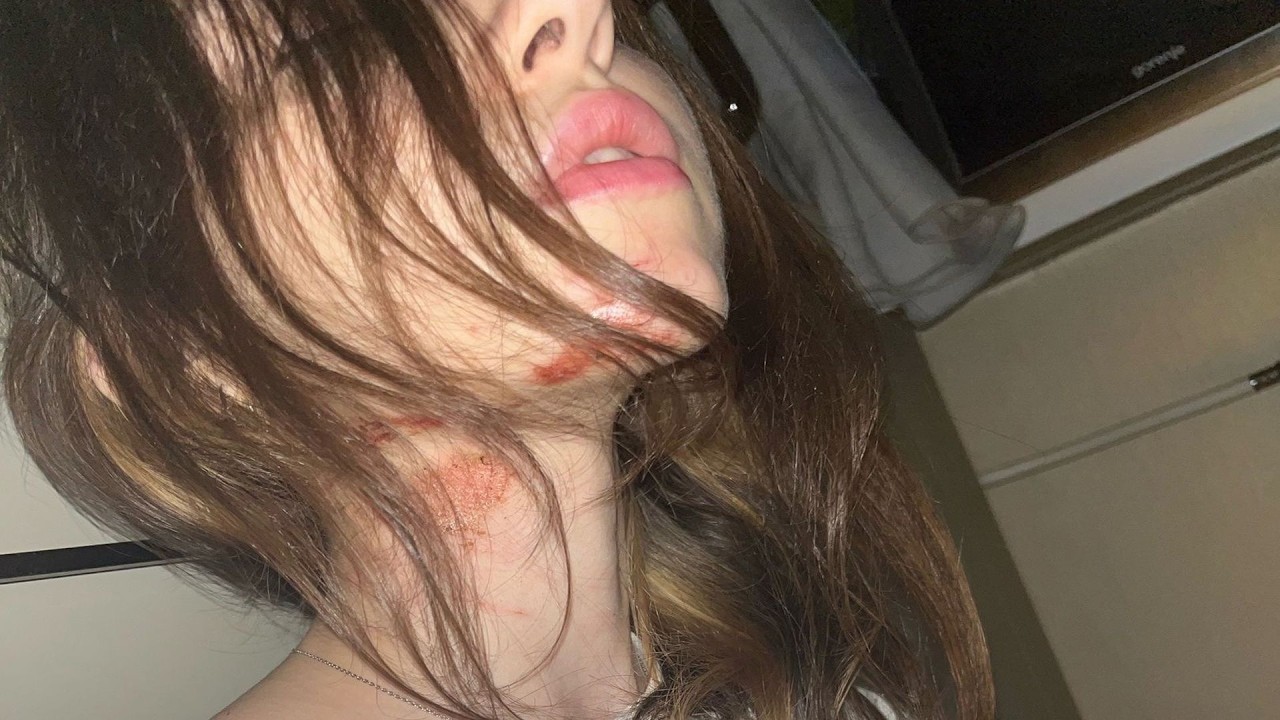 👃 Волосы в носу