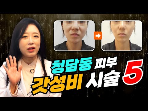 청담동 피부 클리닉 원장이 뽑은 가성비 시술 5 | 피부 관리 입문자라면 "이것부터 시작하세요!" | 청담에끌라드의원