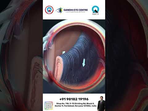 Eye care tips