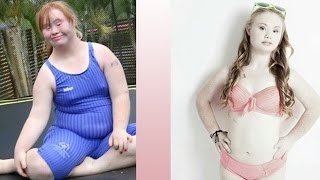 Redefining Beauty Standards: One Girl's Message Of Acceptance