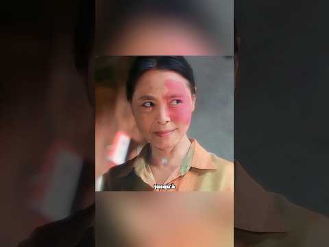 🪱 Le Ver du Visage : La Trahison de Ma Belle-Mère 😱 #shorts  #comedyshorts #trendingnow