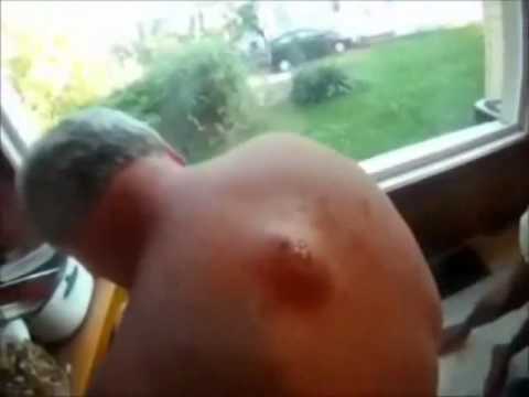 Jak zwiększyć penisa i głowę Przedłużacz na małym penisem