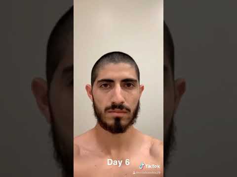 57 day time lapse (bald to grown hair)