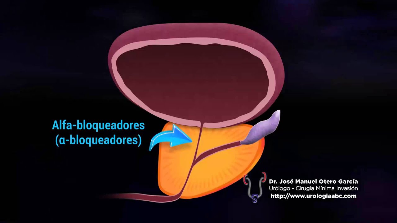 José Manuel Otero García-29