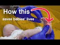 Early Heart Screening: What Every Parent Should Know About the Pulse Ox Test