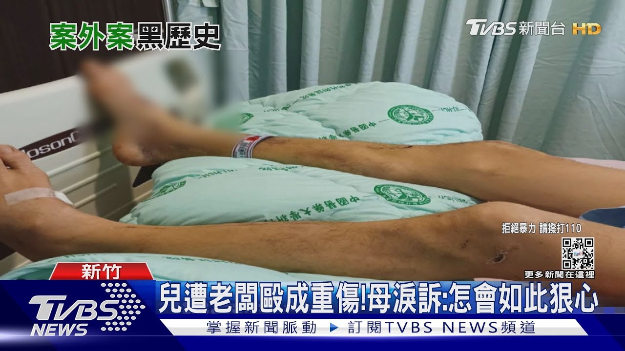 兒遭老闆毆成重傷!母淚訴:怎會如此狠心
