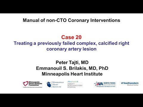 Case 20: PCI Manual: Heavily calcified right coronary artery