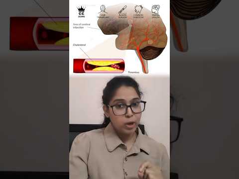 Watch THIS if you're going to SALON/SPA #shorts Dr. Deepthi #salon #spa Crowns Clinic