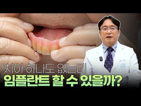 치아가 하나도 없어도 임플란트 가능한가요?