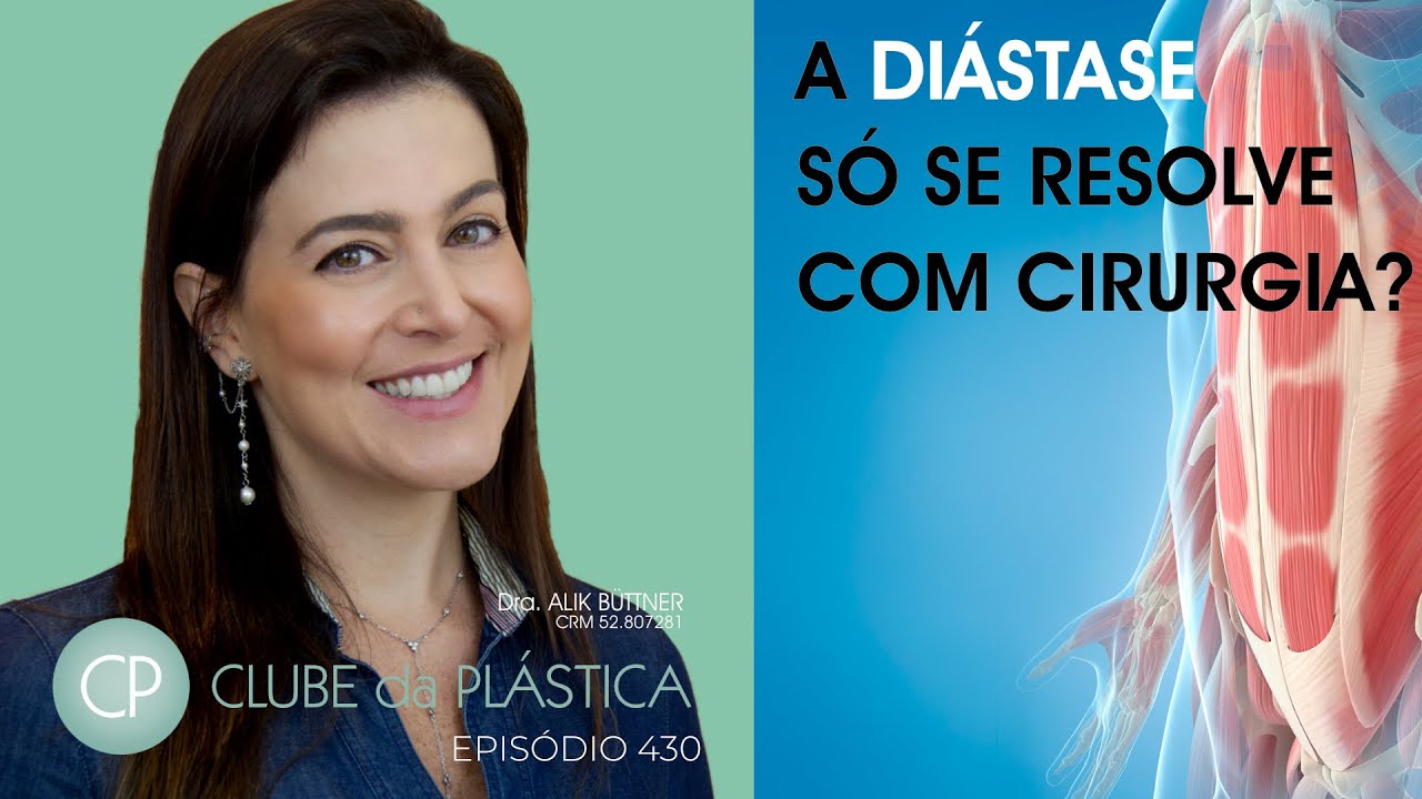 Clube da Plástica: A diástase só se resolve com cirurgia?