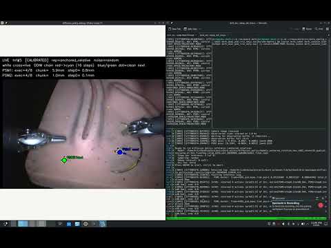 ResNet state-following dVRK trial