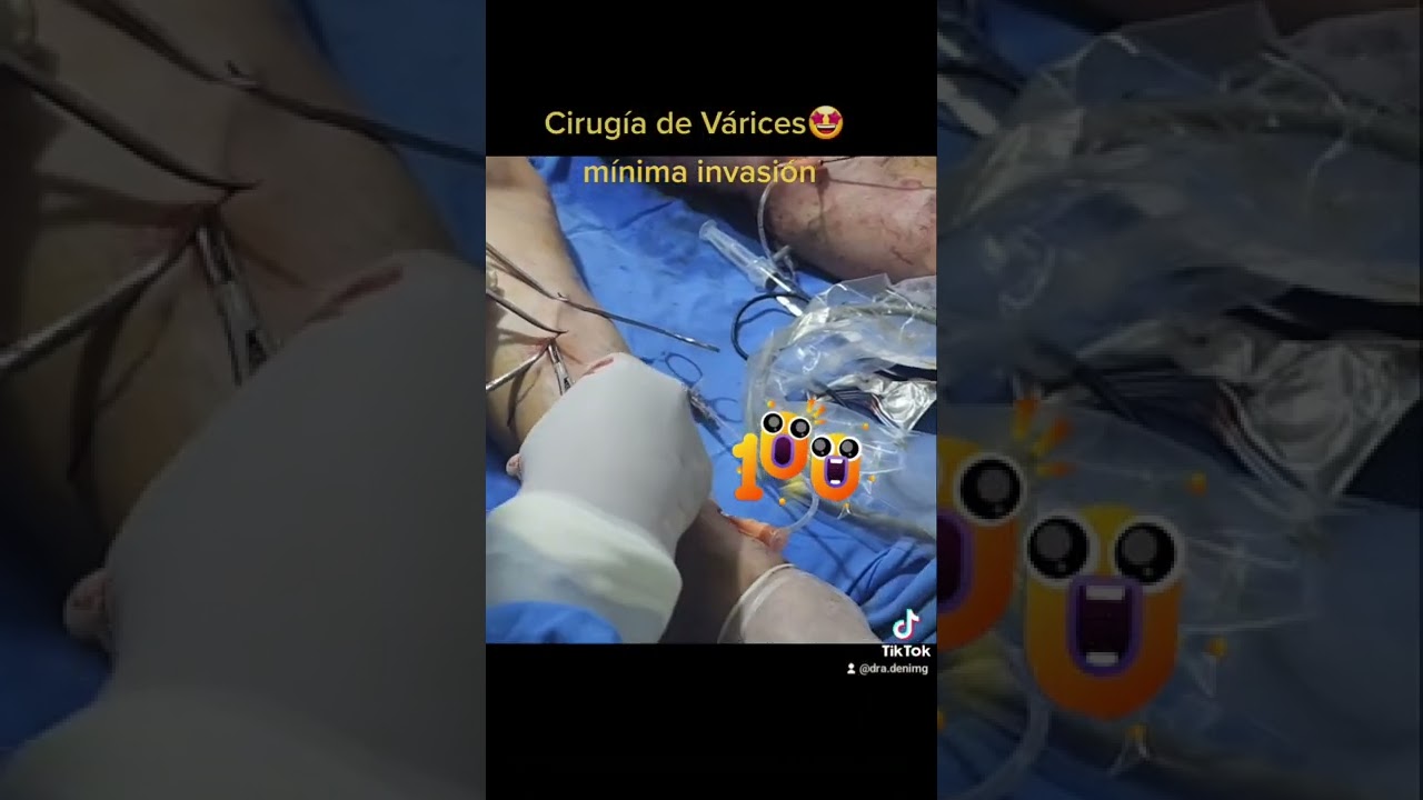 Deni Martínez Gama-22