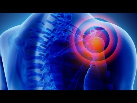 Schmerzen im Bereich Solar-Plexus der rechten oberen Quadranten erstreckt, und zurück Ð ± оР»NOE d² Ð¿Ð¾Ñ Ð½Ð¸Ñ Ñ † d & mgr; D мР° Ñ, Ð¾Ñ Ð½Ð¾Ðμ ÐºÑ ‡ ‡ € овоÑ, ÐμÑ ÐμниÐμ