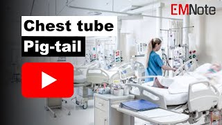 Chest tube or pigtail catheter