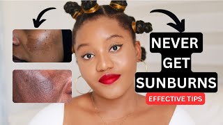 HOW TO TREAT AND GET RID OF SUNBURN & HYPERPIGMENTATION PERMANENTLY FOR A BRIGHT AN EVEN SKIN-TONE