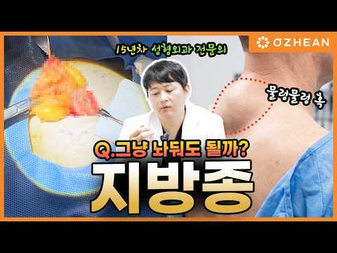 지방종 Q&amp;A ㅣ몸 속에서 움직이는 덩어리 &amp; 혹 제거 해야할까? ㅣ #지방종 #양성종양 #덩어리 #혹