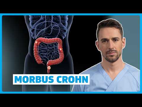 Morbus Crohn verstehen: Ursachen, Symptome, Diagnose & Therapie | DocTommy